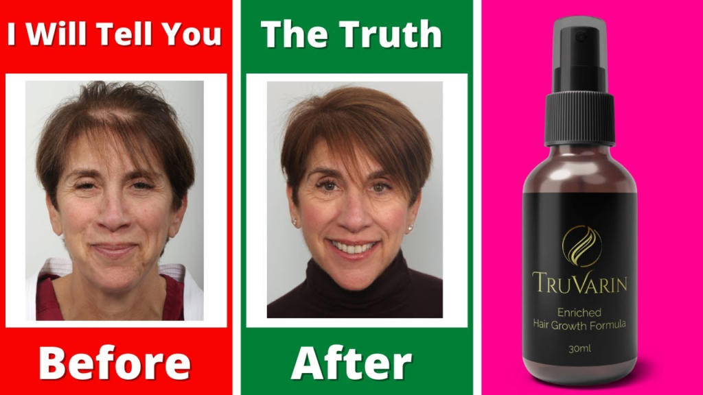 TruVarin Review