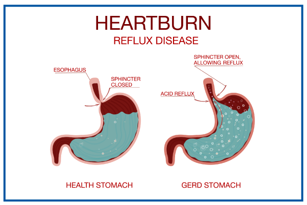 HepatoBurn Review